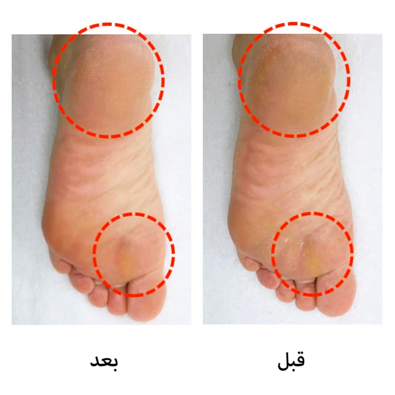 ماسك قدم التمساح - UNNNI